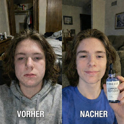 FINESSE PARIS® - SKIN ELIXIR